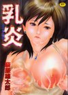 乳炎試し読み1ページ